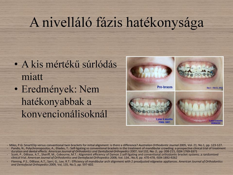 , Eliades, T.: Self-ligating vs conventional brackets in the treatment of mandibular crowding: a prospective clinical trial of treatment duration and dental effects.