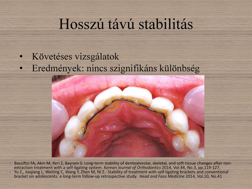 Korean Journal of Orthodontics 2014, Vol.44, No.3, pp.119-127. - Yu Z., Jiaqiang L, Weiting C, Wang Y, Zhen M, Ni Z.