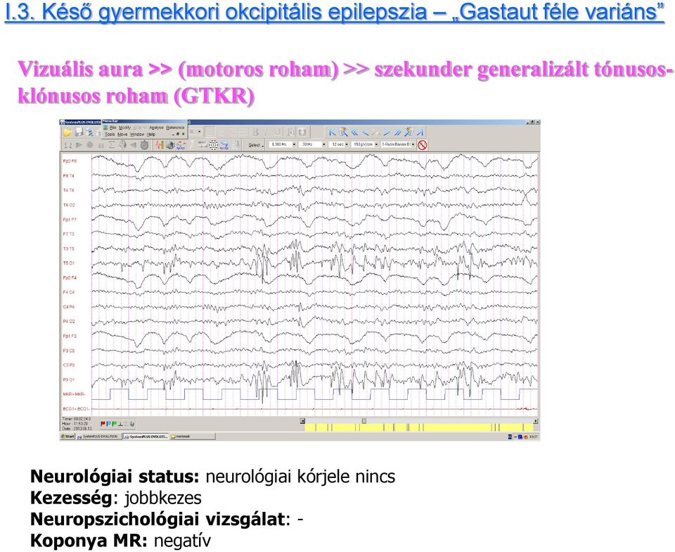 tónusosklónusos roham (GTKR) Neurológiai status: neurológiai