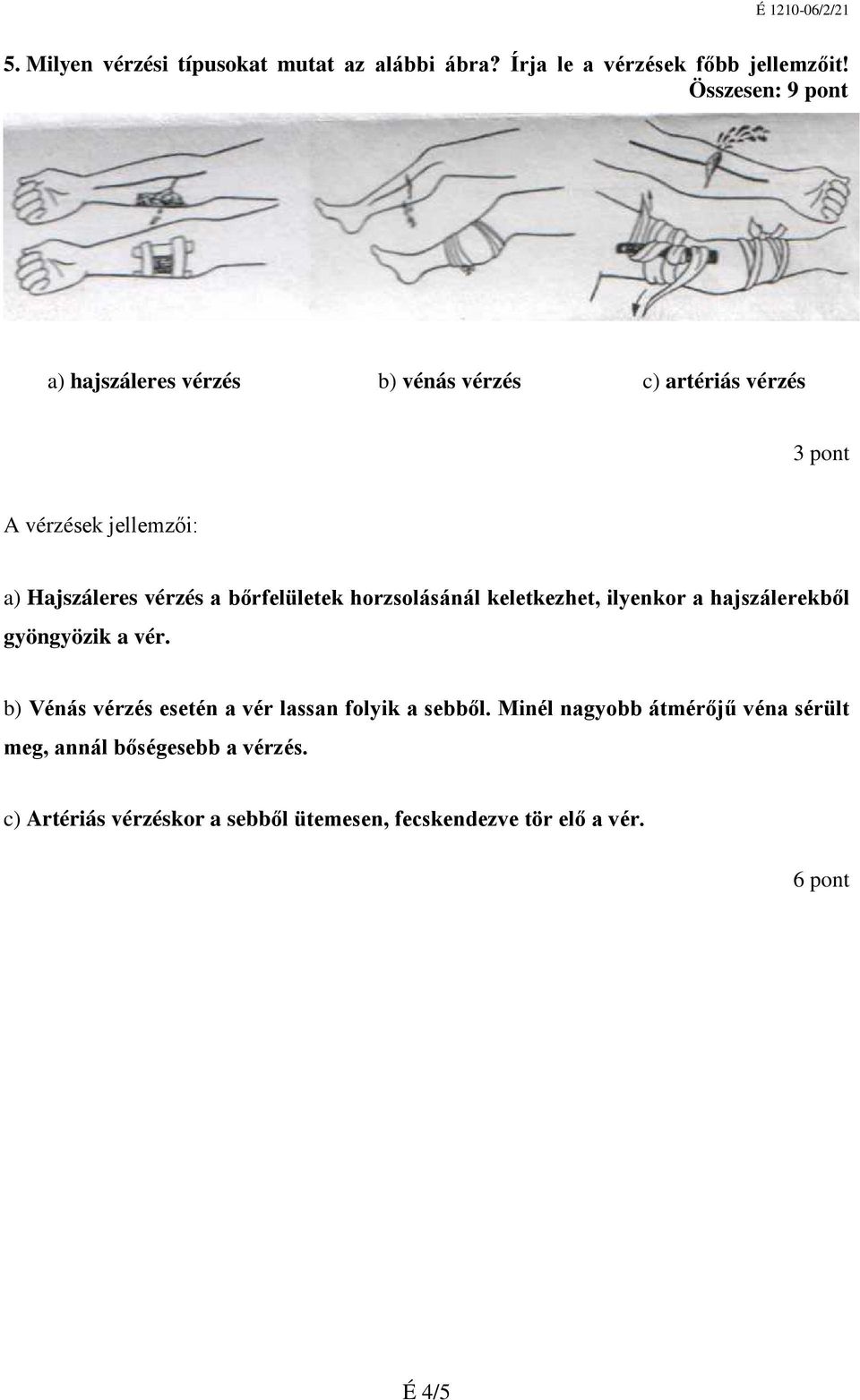 bőrfelületek horzsolásánál keletkezhet, ilyenkor a hajszálerekből gyöngyözik a vér.