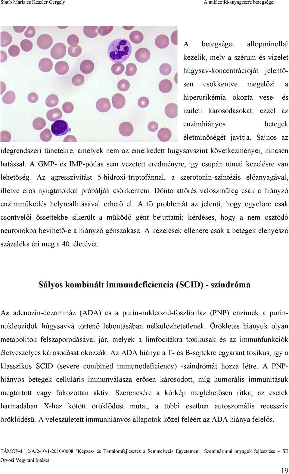 A GMP- és IMP-pótlás sem vezetett eredményre, így csupán tüneti kezelésre van lehetőség.