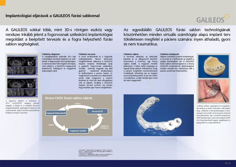 Az egyedülálló GALILEOS fúrási sablon technológiának köszönhetõen minden virtuális számítógép alapú implant terv tökéletesen megfelel a páciens számára: ínyen áthaladó, gyors és nem traumatikus.