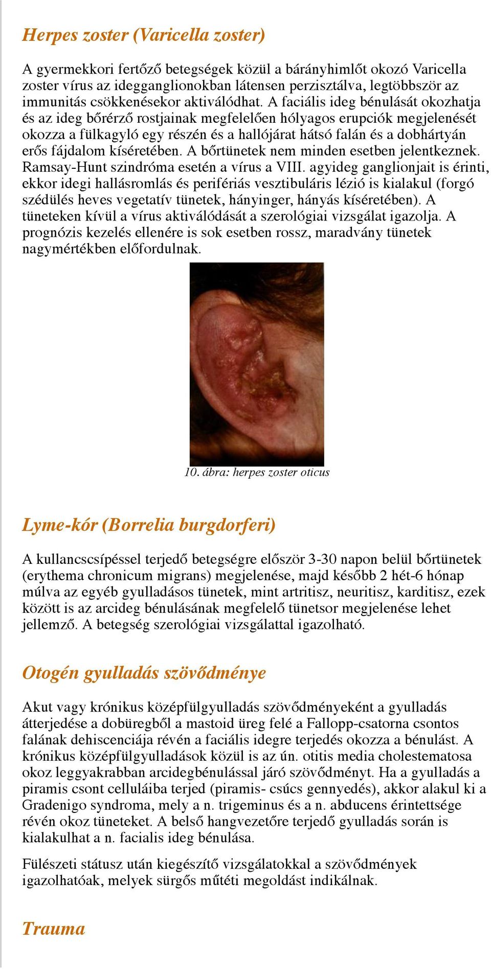 A faciális ideg bénulását okozhatja és az ideg bőrérző rostjainak megfelelően hólyagos erupciók megjelenését okozza a fülkagyló egy részén és a hallójárat hátsó falán és a dobhártyán erős fájdalom