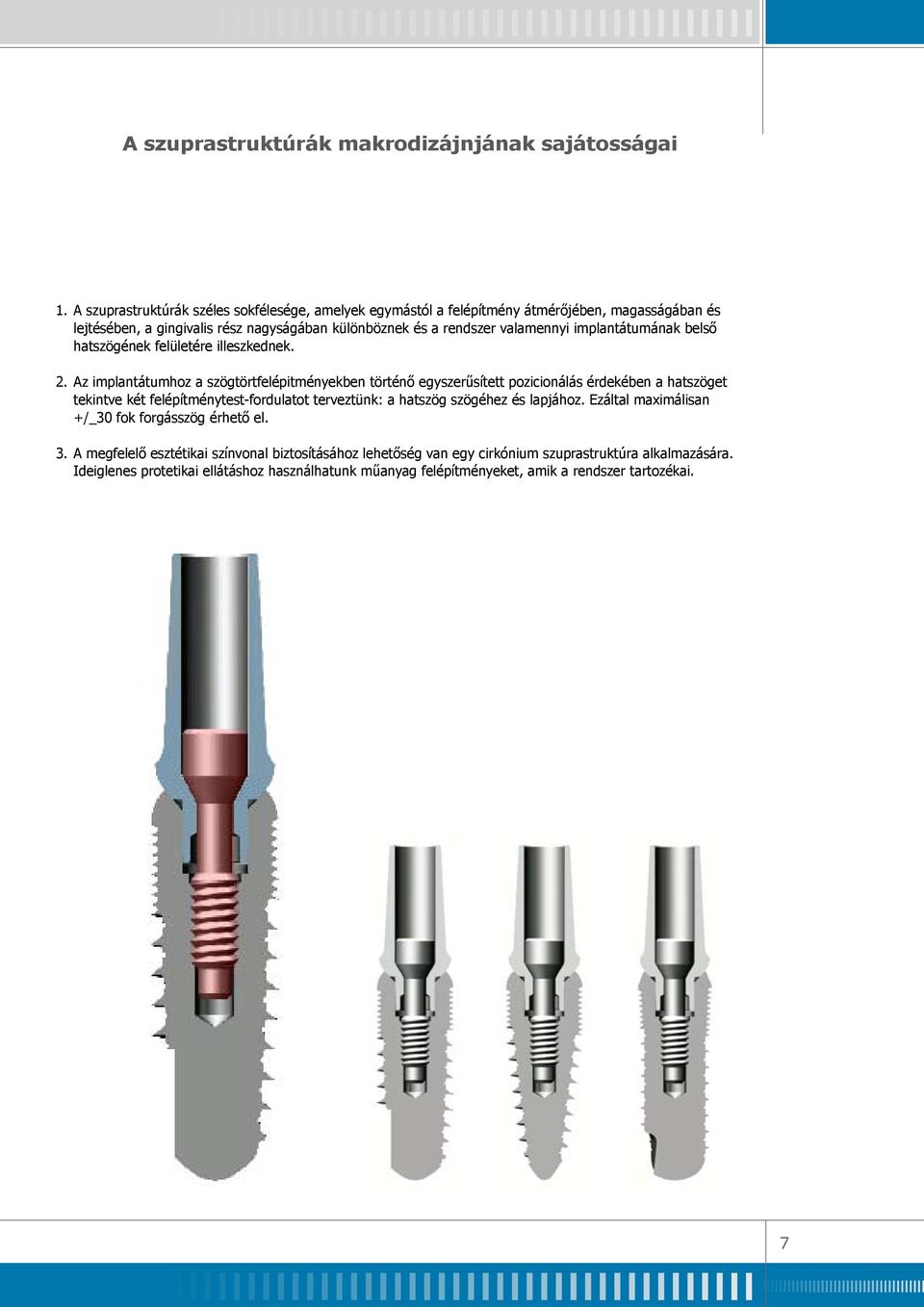 implantátumának belső hatszögének felületére illeszkednek. 2.