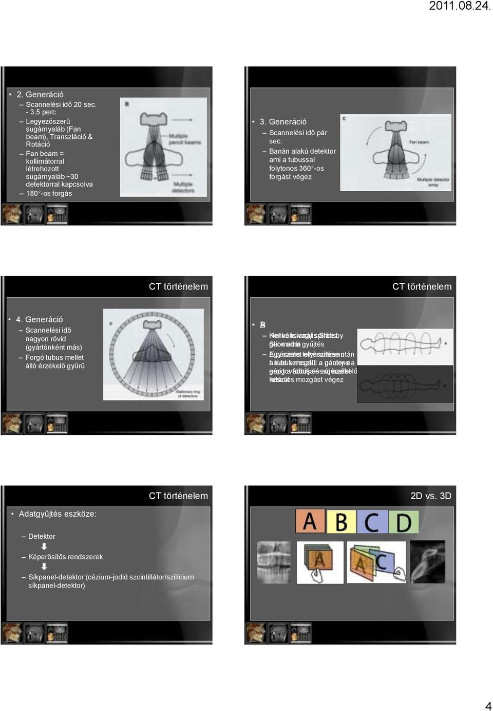 Generáció Scannelési idő nagyon rövid (gyártónként más) Forgó tubus mellet álló érzékelő gyűrű AB Konvencionális Helikális vagy spirális Slice by Slice geometria adat gyűjtés Egy A páciens szelet