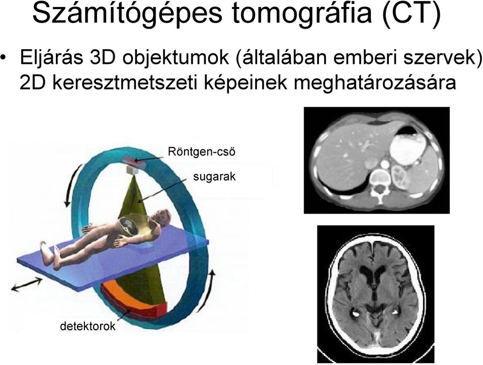 szervek) 2D keresztmetszeti képeinek