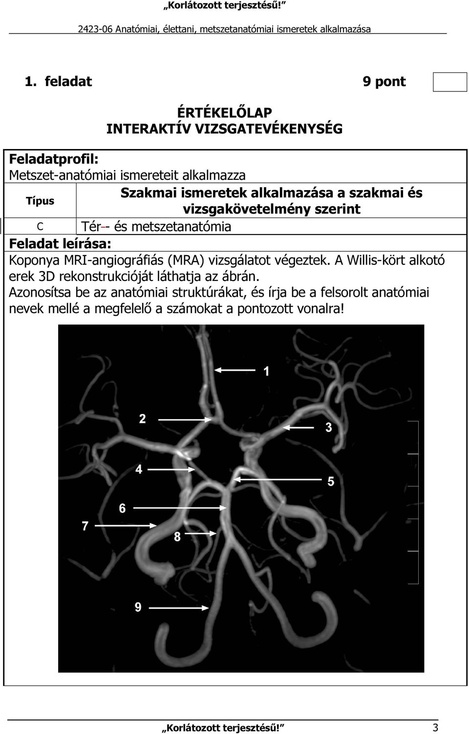 Koponya MRI-angiográfiás (MRA) vizsgálatot végeztek. A Willis-kört alkotó erek 3D rekonstrukcióját láthatja az ábrán.