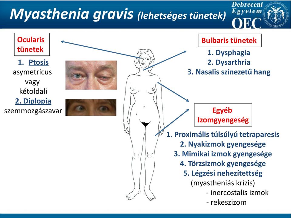 Nasalis színezetű hang Egyéb Izomgyengeség 1. Proximális túlsúlyú tetraparesis 2.