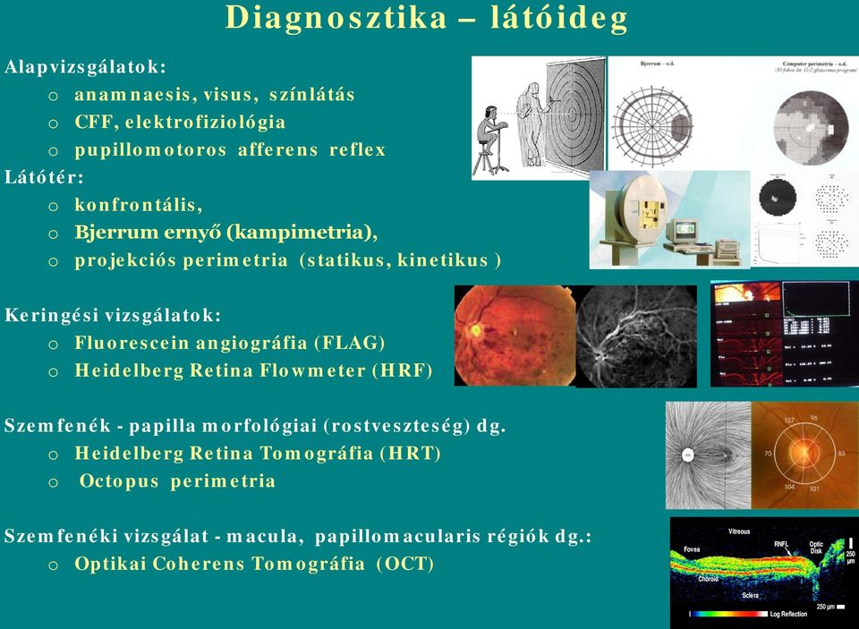 Retina Flwmeter (HRF) Szemfenék - papilla mrflógiai (rstveszteség) dg.