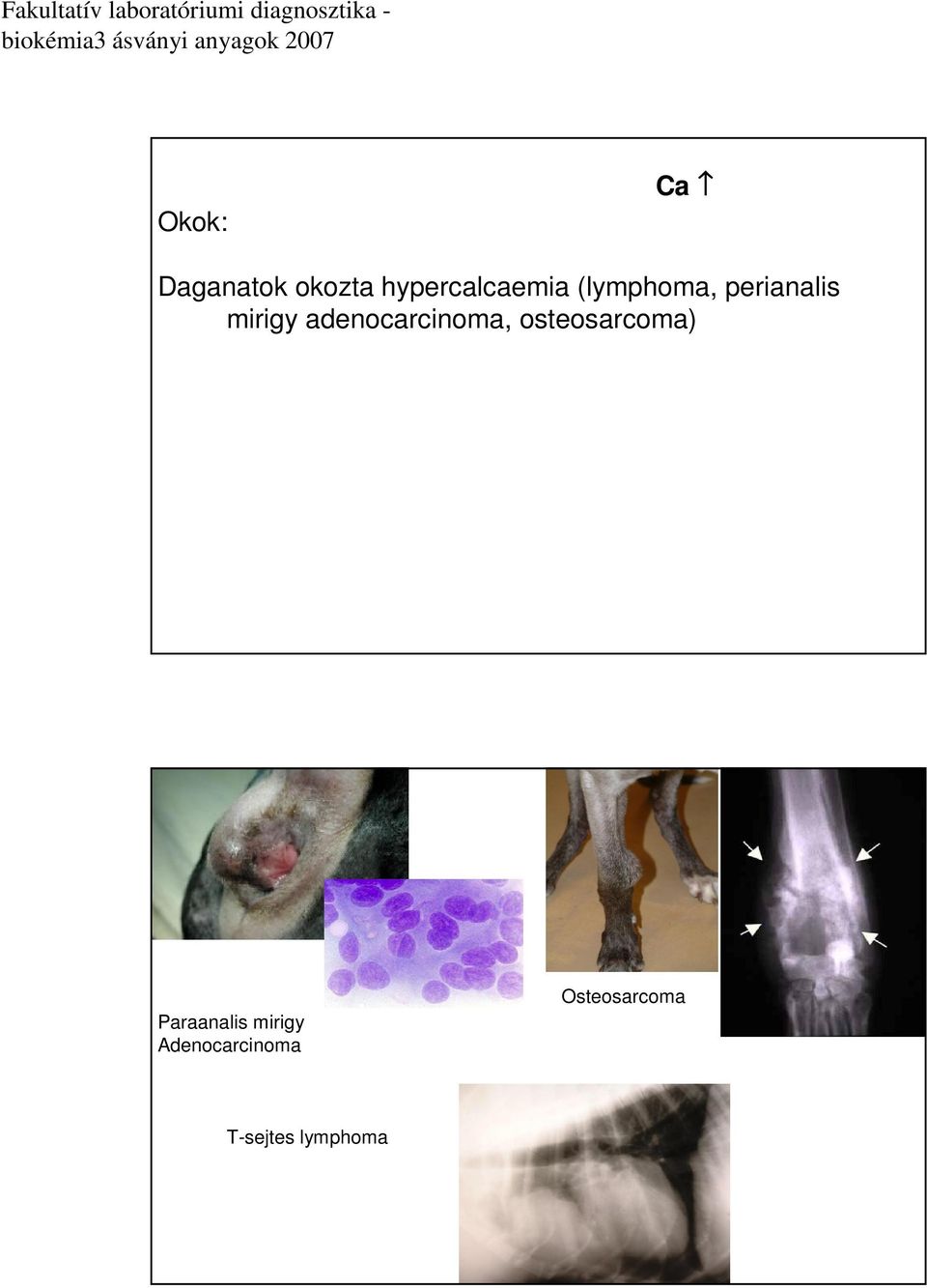 adenocarcinoma, osteosarcoma) Paraanalis