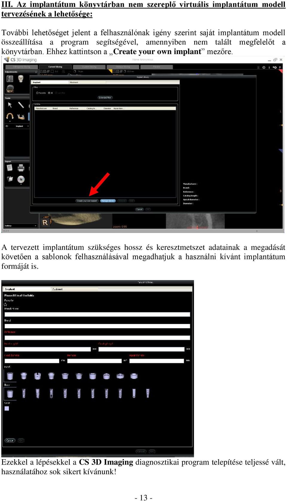 Ehhez kattintson a Create your own implant mezőre.
