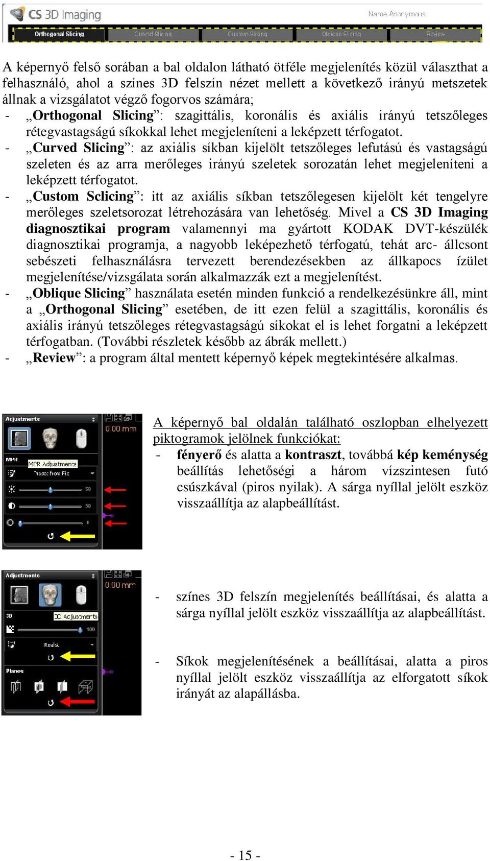- Curved Slicing : az axiális síkban kijelölt tetszőleges lefutású és vastagságú szeleten és az arra merőleges irányú szeletek sorozatán lehet megjeleníteni a leképzett térfogatot.