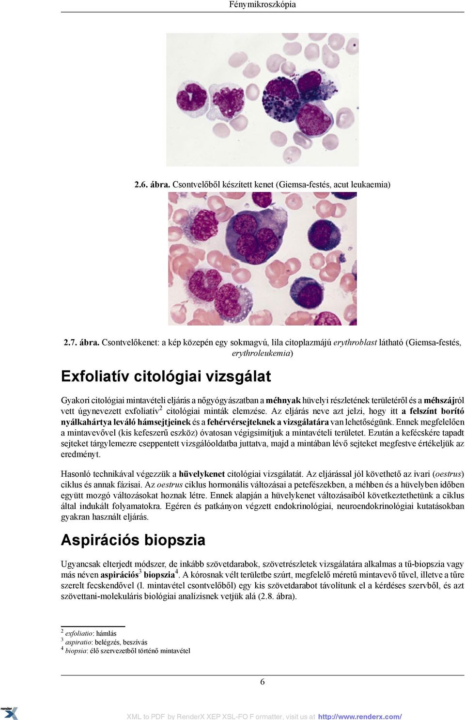 Csontvelőkenet: a kép közepén egy sokmagvú, lila citoplazmájú erythroblast látható (Giemsa-festés, erythroleukemia) Exfoliatív citológiai vizsgálat Gyakori citológiai mintavételi eljárás a