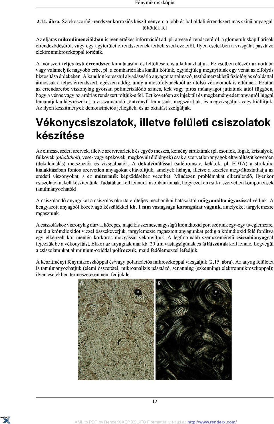 a vese érrendszeréről, a glomeruluskapillárisok elrendeződéséről, vagy egy agyterület érrendszerének térbeli szerkezetéről. Ilyen esetekben a vizsgálat pásztázó elektronmikroszkóppal történik.