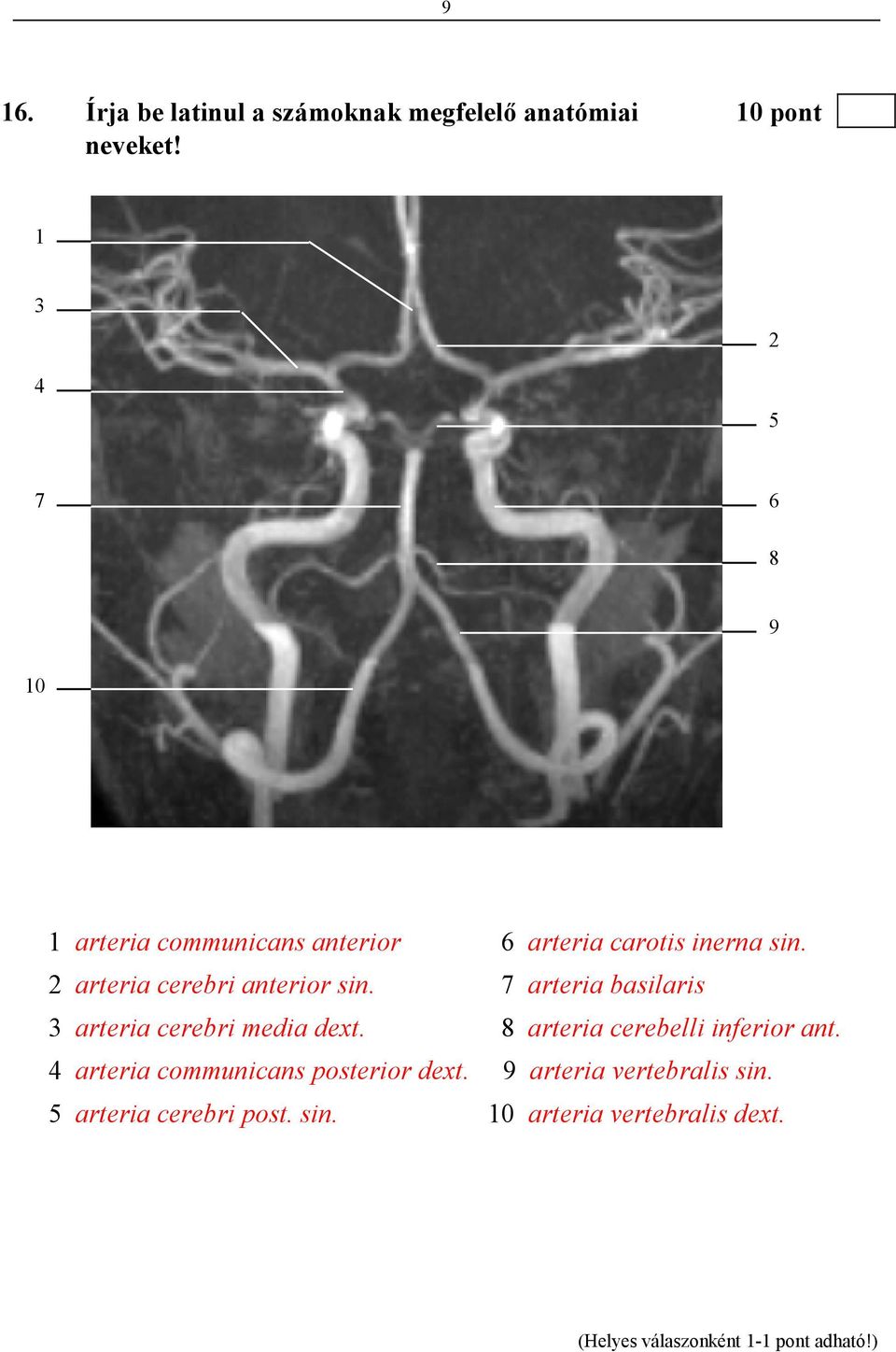 2 arteria cerebri anterior sin. 7 arteria basilaris 3 arteria cerebri media dext.