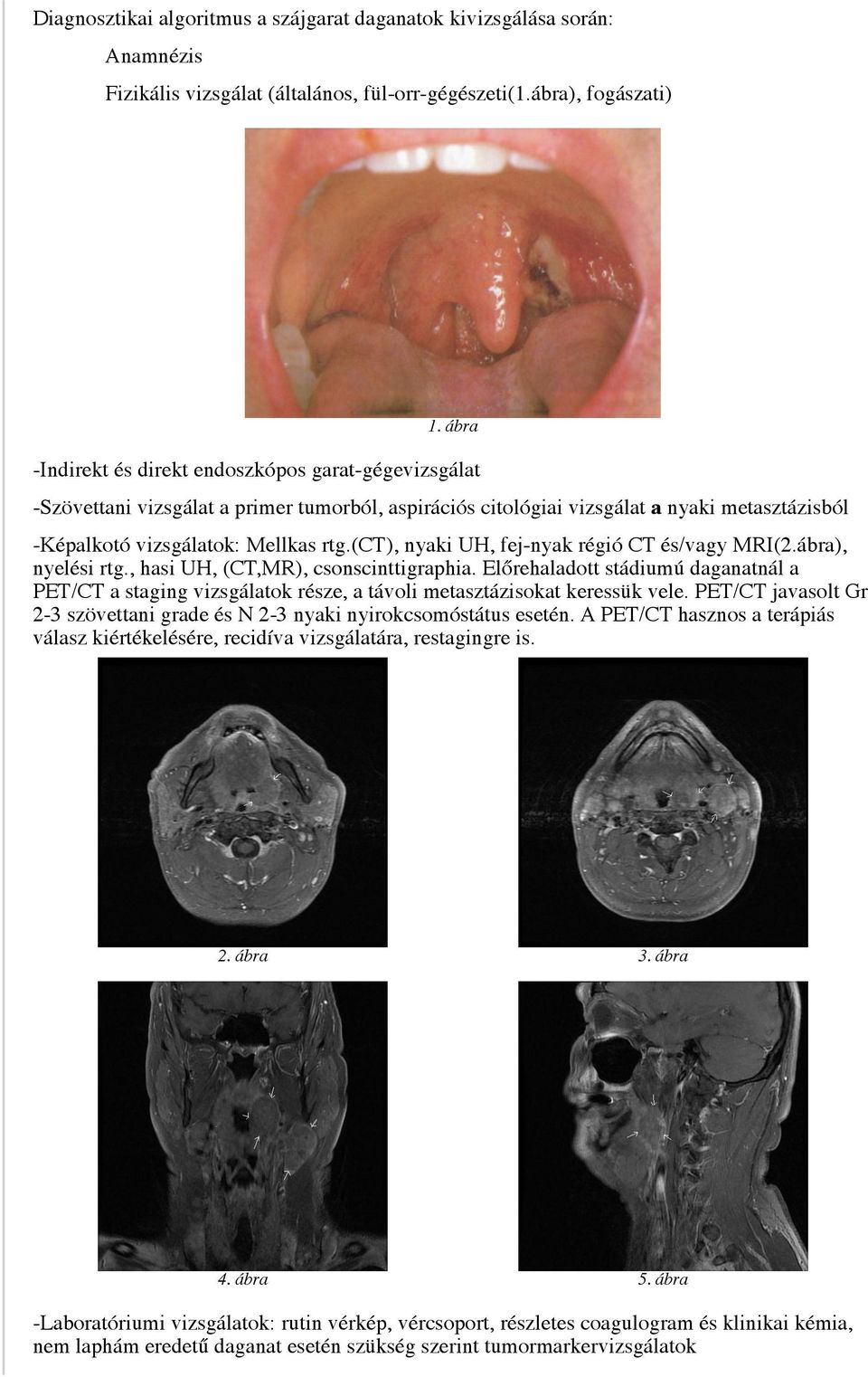 (ct), nyaki UH, fej-nyak régió CT és/vagy MRI(2.ábra), nyelési rtg., hasi UH, (CT,MR), csonscinttigraphia.