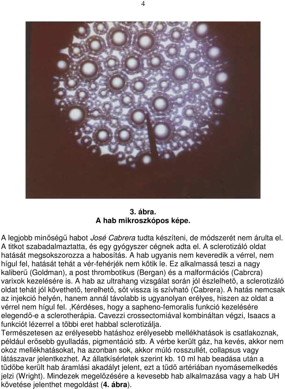 Ez alkalmassá teszi a nagy kaliberő (Goldman), a post thrombotikus (Bergan) és a malformációs (Cabrcra) varixok kezelésére is.