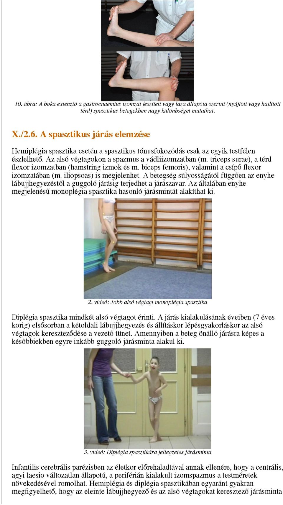 triceps surae), a térd flexor izomzatban (hamstring izmok és m. biceps femoris), valamint a csípő flexor izomzatában (m. iliopsoas) is megjelenhet.