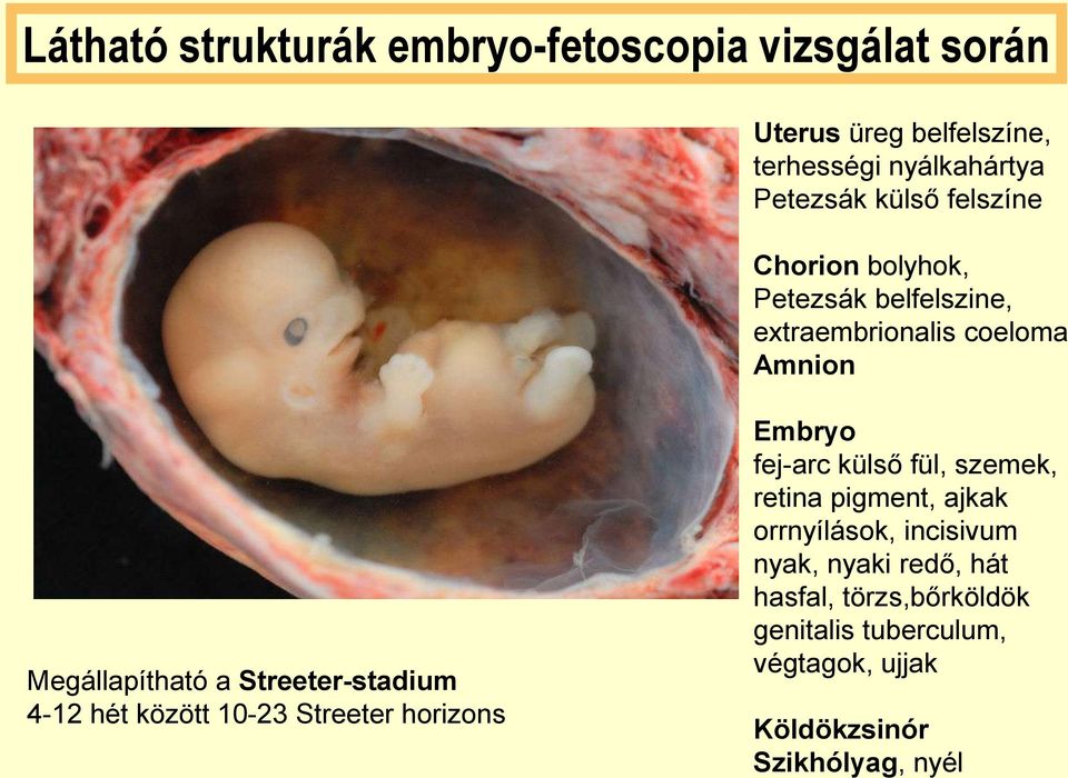 Streeter-stadium 4-12 hét között 10-23 Streeter horizons Embryo fej-arc külső fül, szemek, retina pigment, ajkak