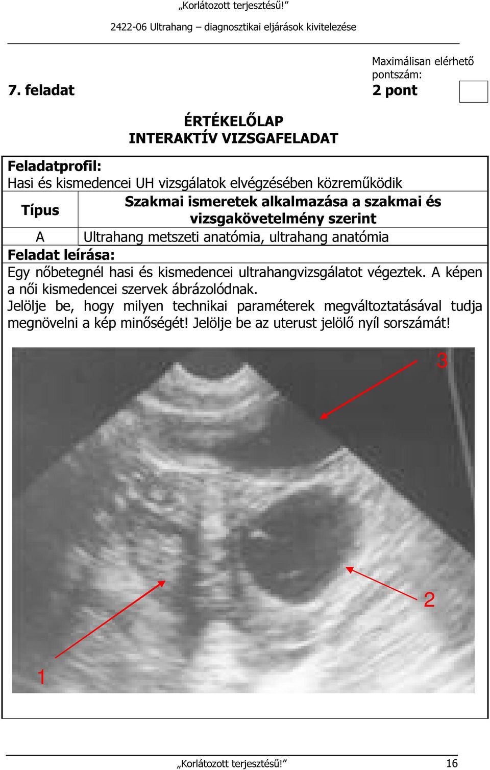 alkalmazása a szakmai és Típus vizsgakövetelmény szerint A Ultrahang metszeti anatómia, ultrahang anatómia Feladat leírása: Egy nőbetegnél hasi