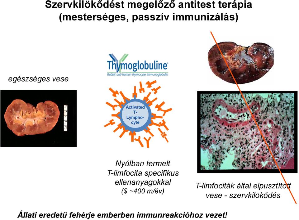 ellenanyagokkal ($ ~400 m/év) T-limfociták által elpusztított vese