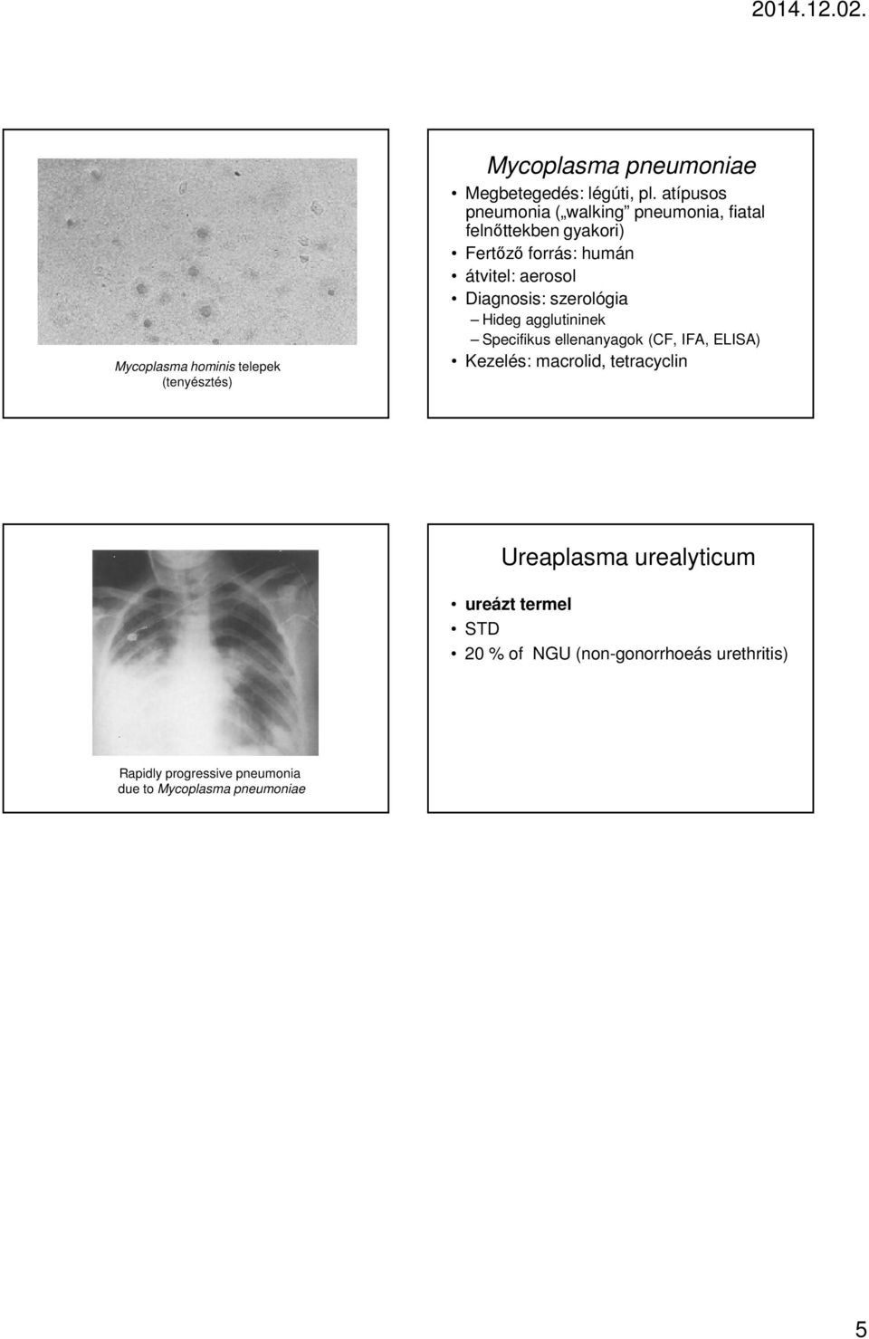 Diagnosis: szerológia Hideg agglutininek Specifikus ellenanyagok (CF, IFA, ELISA) Kezelés: macrolid, tetracyclin