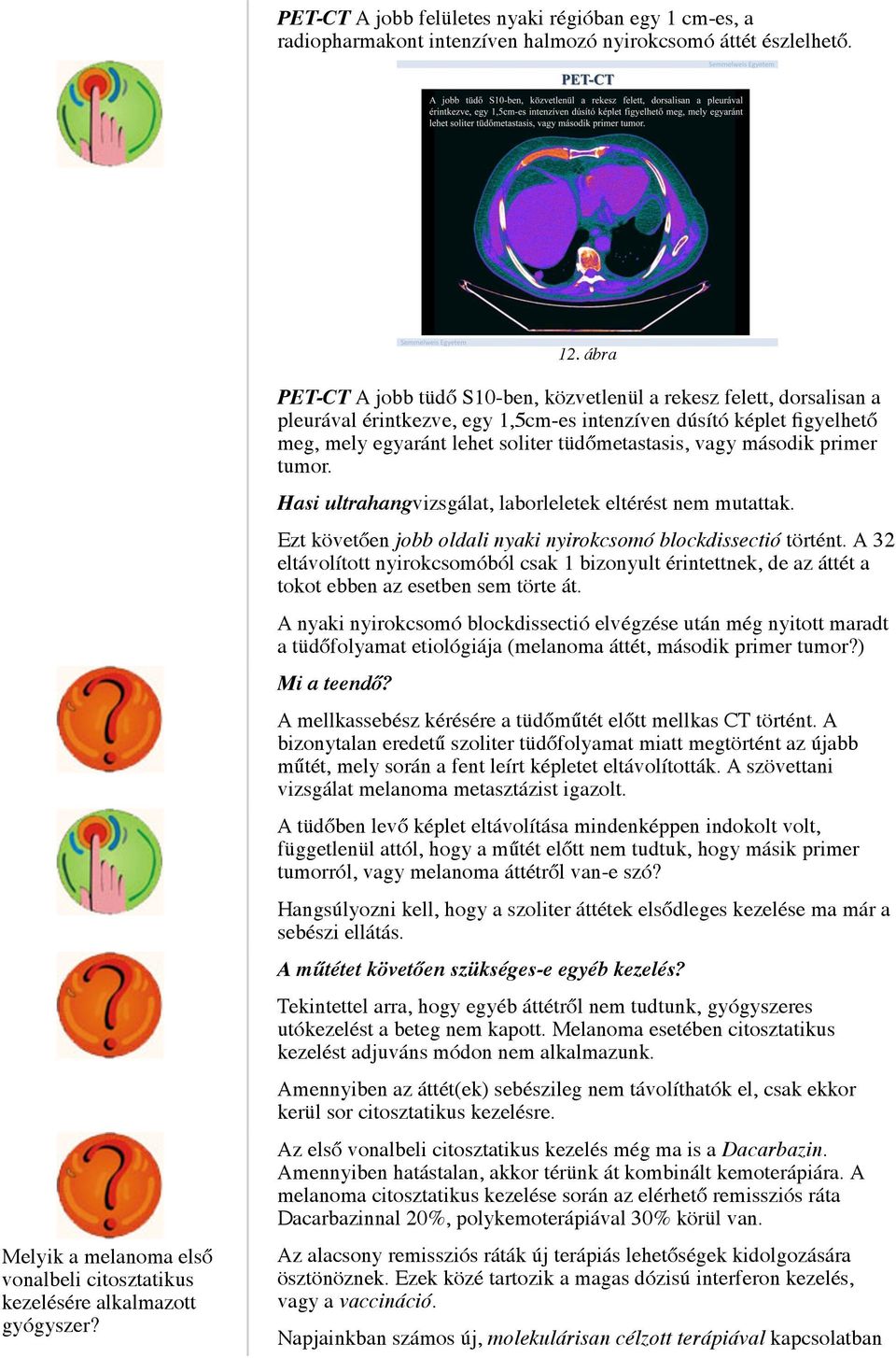 PET-CT A jobb tüdő S10-ben, közvetlenül a rekesz felett, dorsalisan a pleurával érintkezve, egy 1,5cm-es intenzíven dúsító képlet figyelhető meg, mely egyaránt lehet soliter tüdőmetastasis, vagy