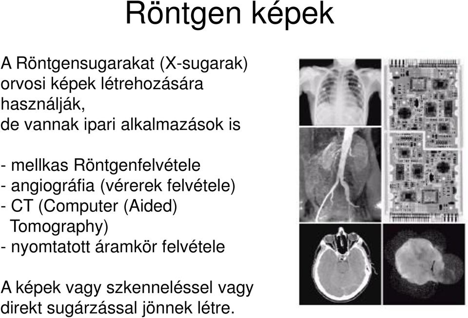 angiográfia (vérerek felvétele) - CT (Computer (Aided) Tomography) -