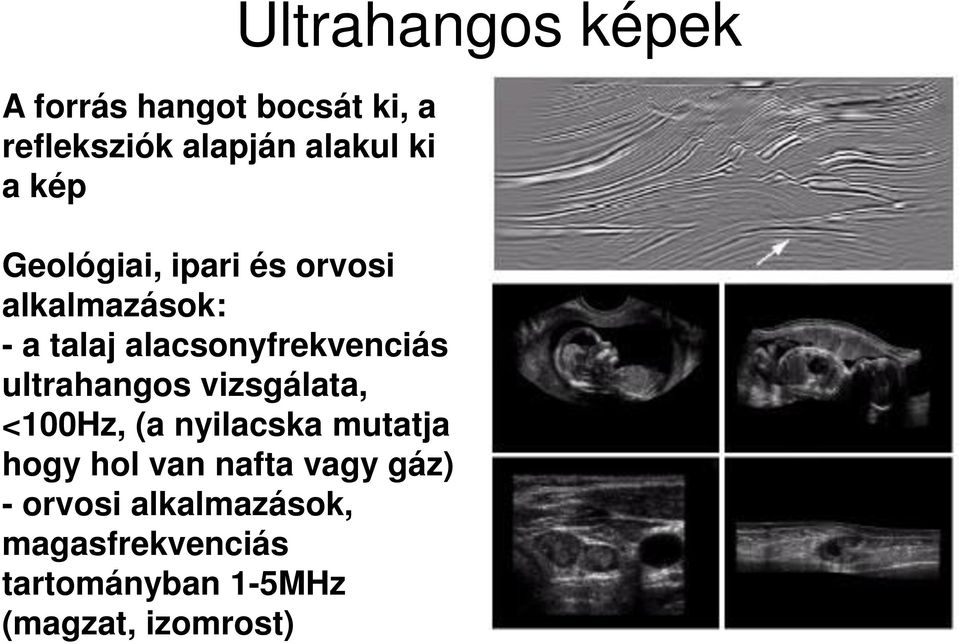 vizsgálata, <100Hz, (a nyilacska mutatja hogy hol van nafta vagy gáz) - orvosi