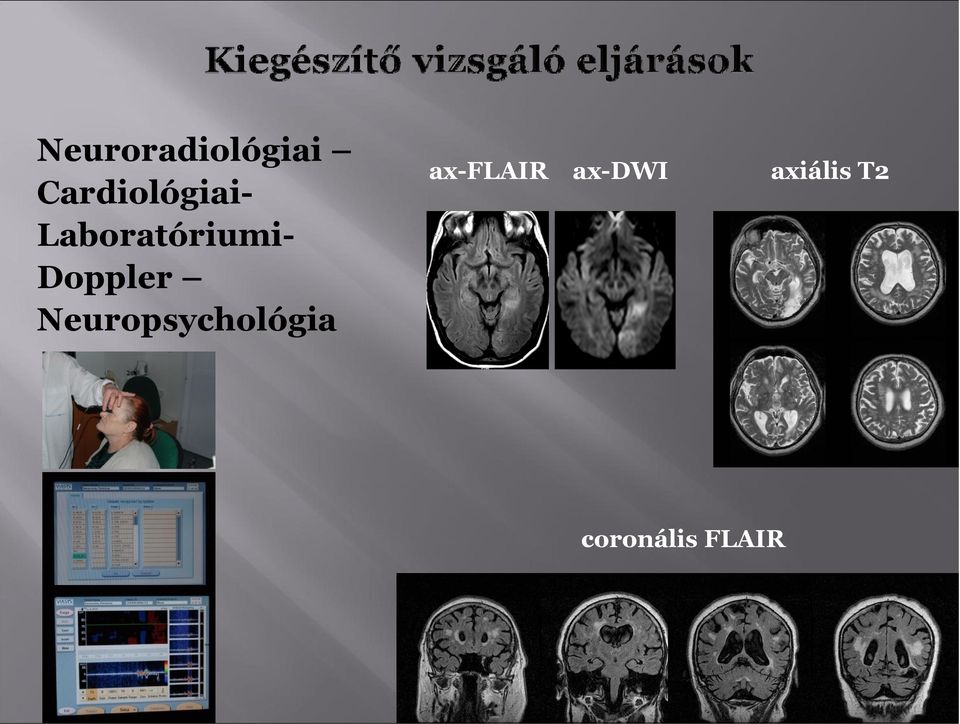 Dppler Neurpsychlógia