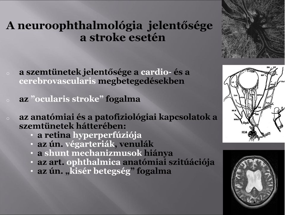 kapcslatk a szemtünetek hátterében: a retina hyperperfúziója az ún.