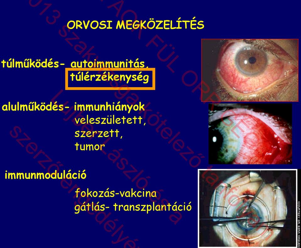 immunhiányok veleszületett, szerzett, tumor