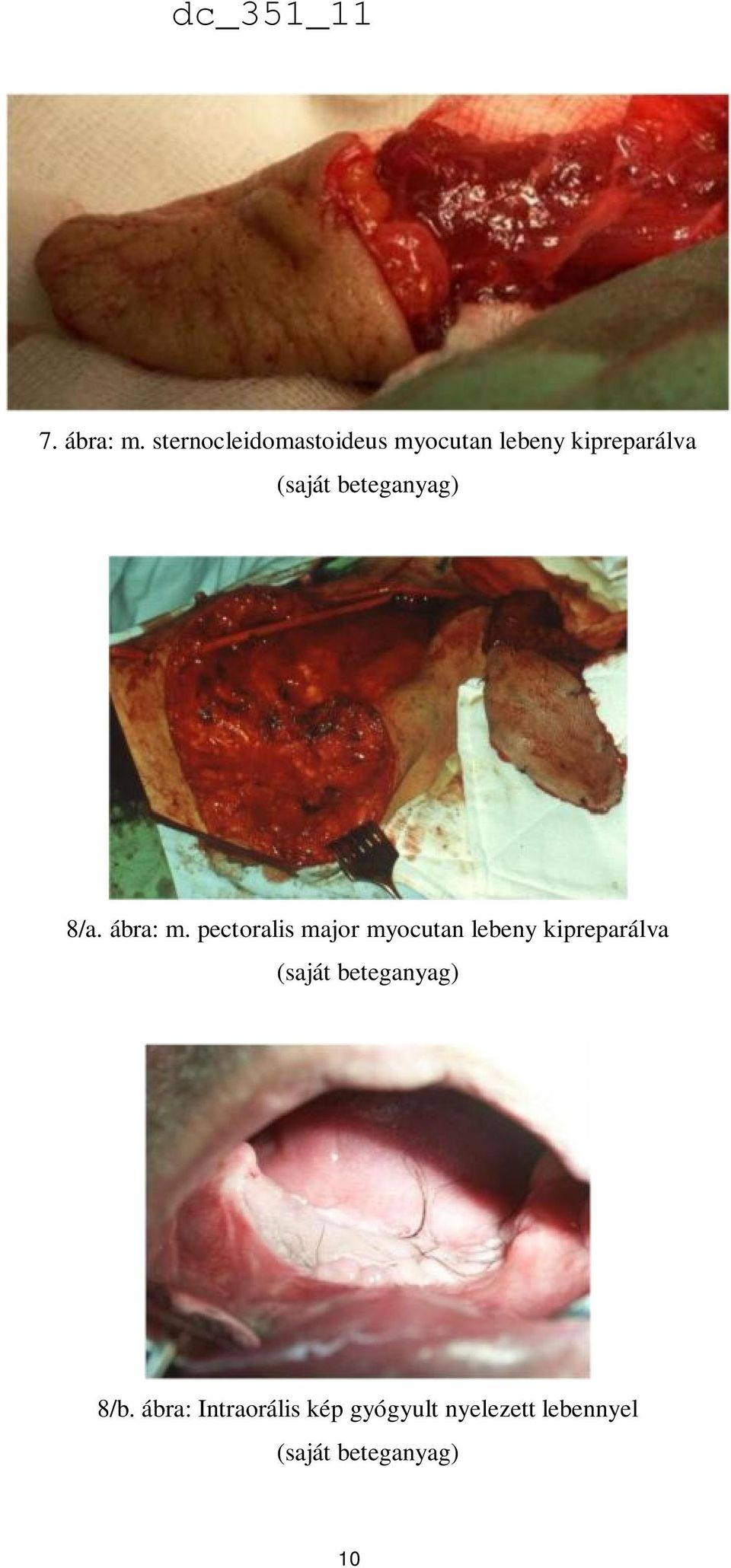 beteganyag) 8/a. ábra: m.