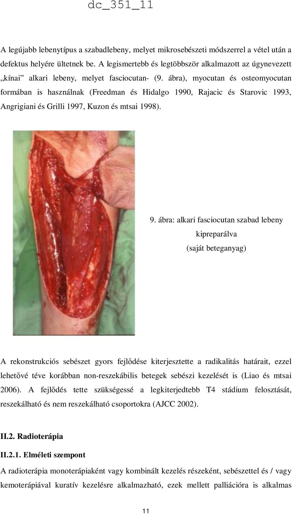ábra), myocutan és osteomyocutan formában is használnak (Freedman és Hidalgo 1990, Rajacic és Starovic 1993, Angrigiani és Grilli 1997, Kuzon és mtsai 1998). 9.