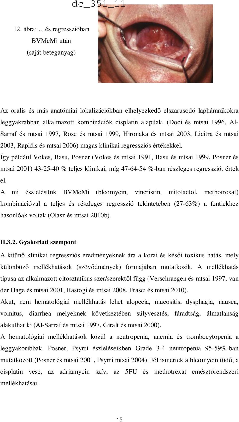 Így például Vokes, Basu, Posner (Vokes és mtsai 1991, Basu és mtsai 1999, Posner és mtsai 2001) 43-25-40 % teljes klinikai, míg 47-64-54 %-ban részleges regressziót értek el.