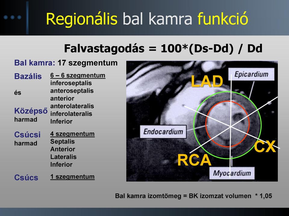 anterolateralis inferolateralis Inferior LAD Csúcsi harmad 4 szegmentum Septalis