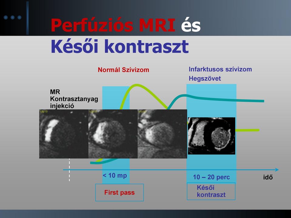 Hegszövet MR Kontrasztanyag injekció <