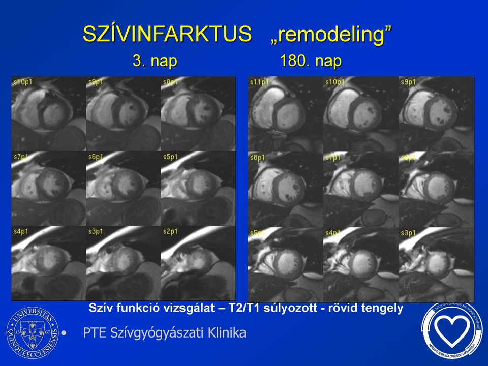 nap Szív funkció vizsgálat