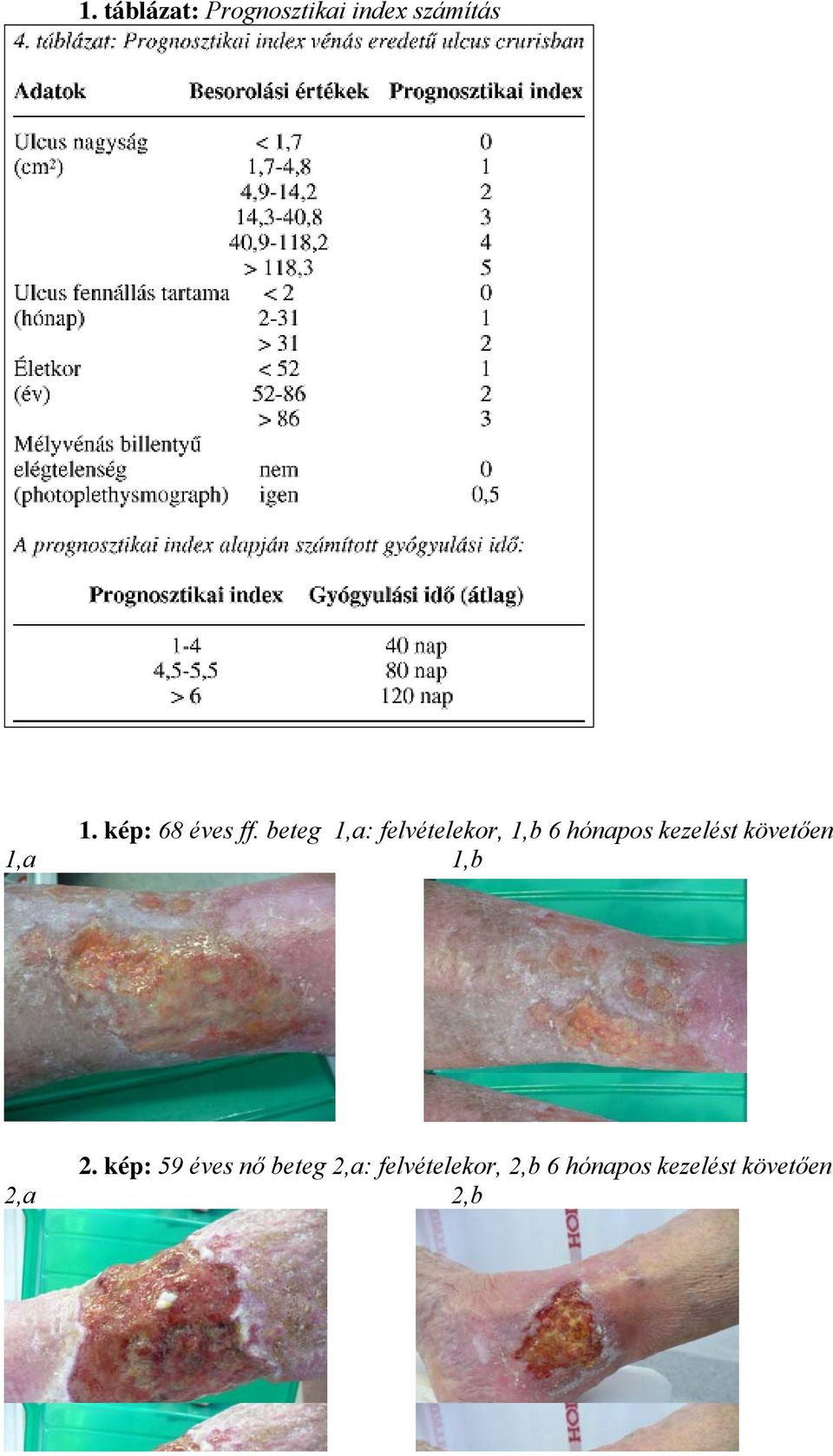 beteg 1,a: felvételekor, 1,b 6 hónapos kezelést