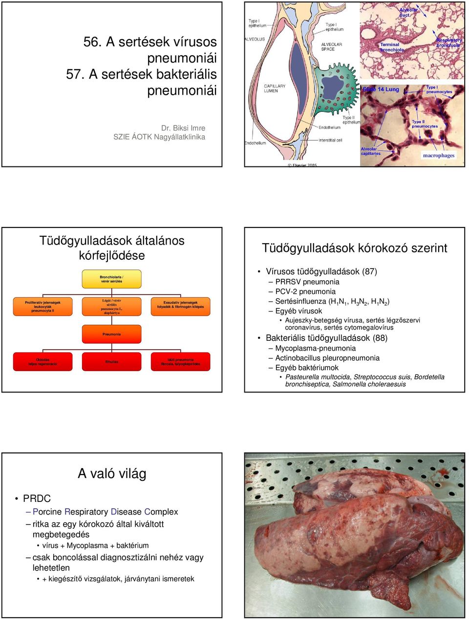 Bronchiolaris / vérér sérülés Légút / vérér sérülés pneumocyta I.