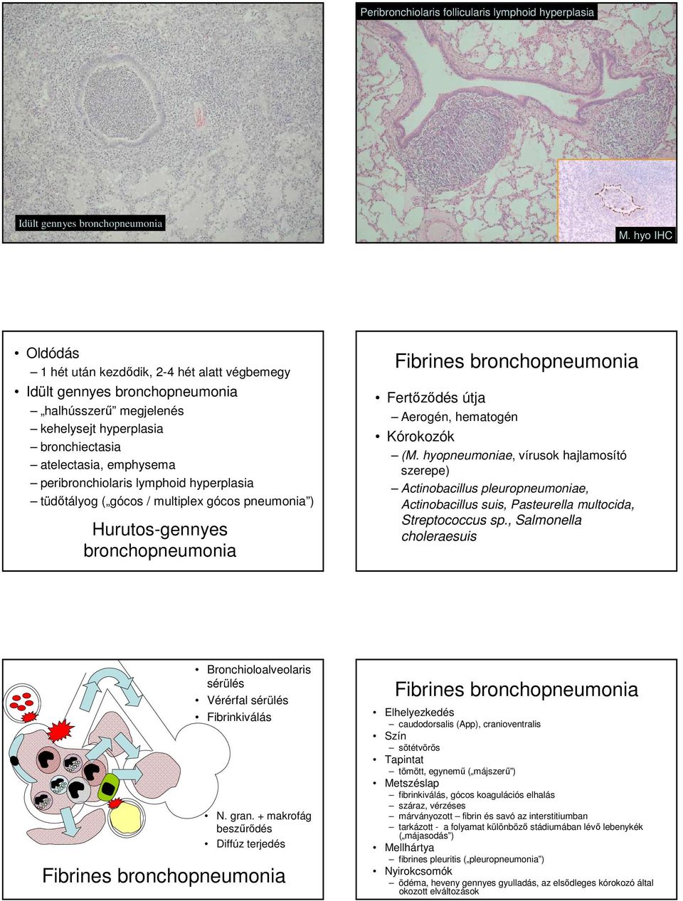 hyperplasia tüdıtályog ( gócos / multiplex gócos ) Hurutos-gennyes broncho Fibrines broncho Fertızıdés útja Aerogén, hematogén (M.