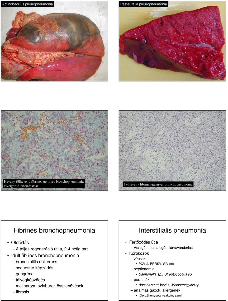 bronchiolitis obliterans sequester képzıdés gangréna tályogképzıdés mellhártya- szívburok összenövések fibrosis Interstitialis Fertızıdés útja