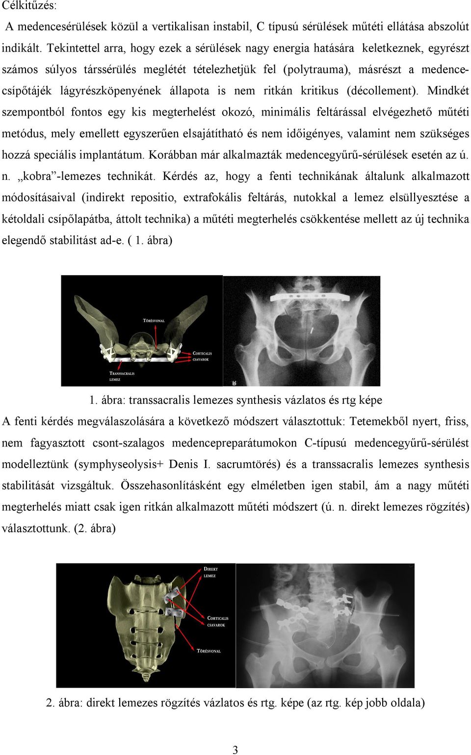 állapota is nem ritkán kritikus (décollement).
