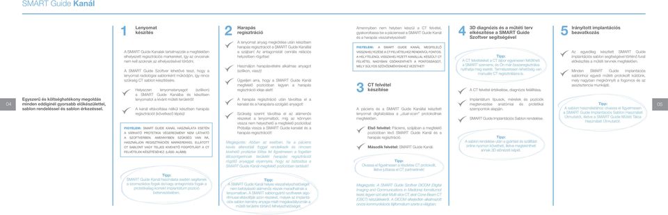 A SMART Guide Szoftver lehetővé teszi, hogy a lenyomat radiológiai sablonként működjön, így nincs szükség CT sablon készítésére.