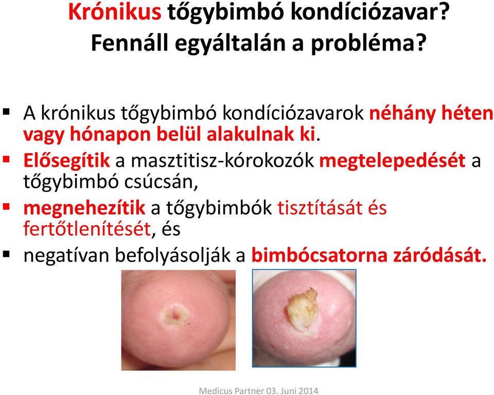 Elősegítik a masztitisz-kórokozók megtelepedését a tőgybimbó csúcsán, megnehezítik