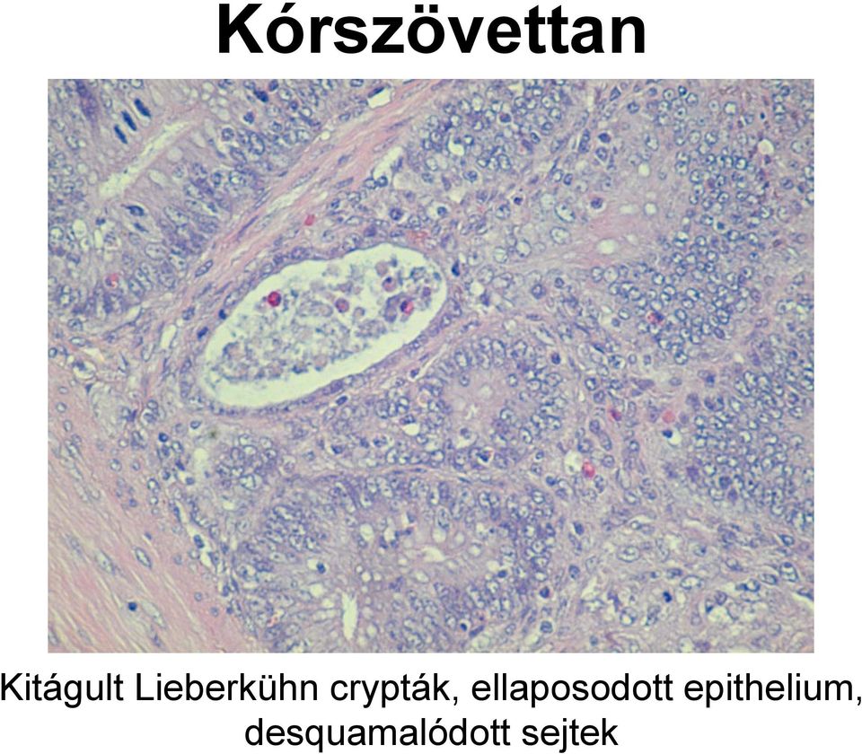 ellaposodott