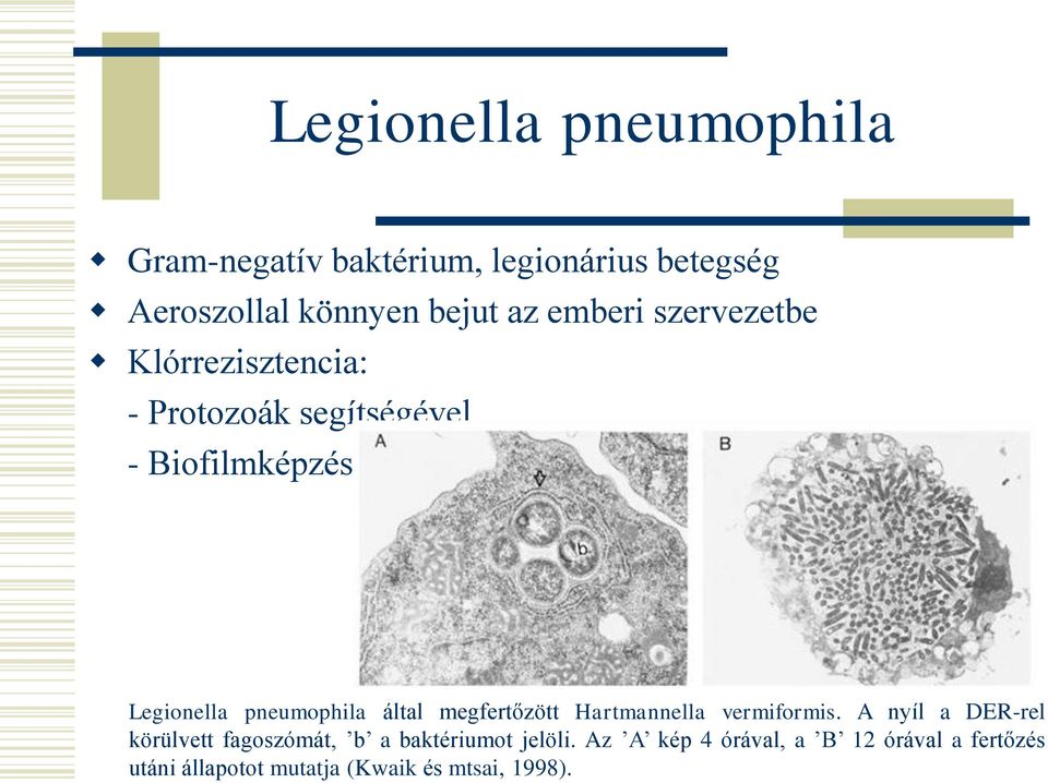 pneumophila által megfertőzött Hartmannella vermiformis.