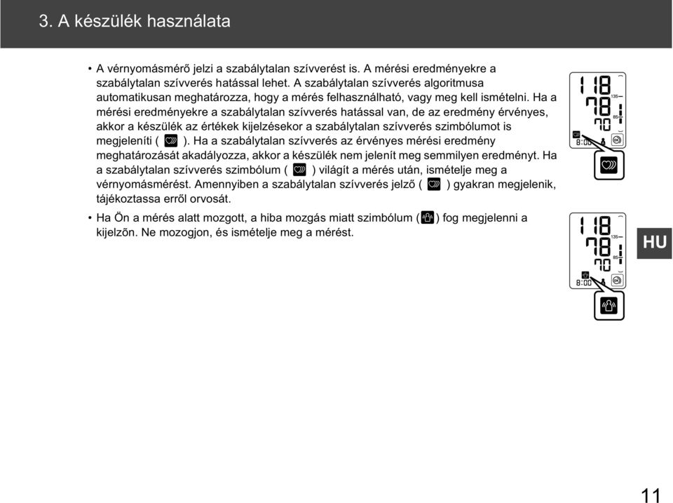 Ha a mérési eredményekre a szabálytalan szívverés hatással van, de az eredmény érvényes, akkor a készülék az értékek kijelzésekor a szabálytalan szívverés szimbólumot is megjeleníti ( ).