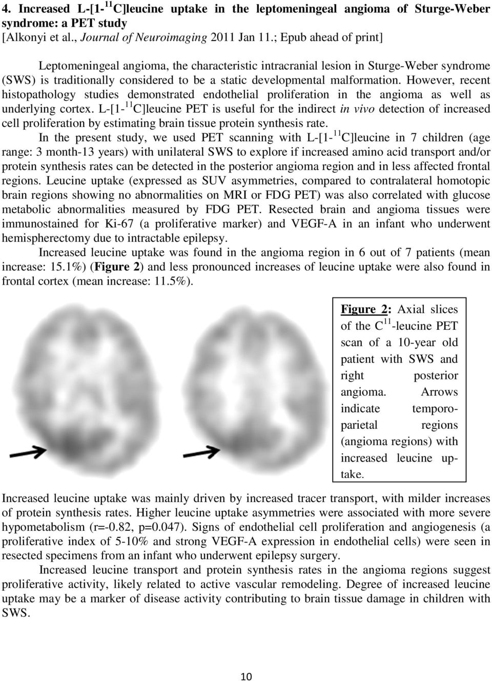 However, recent histopathology studies demonstrated endothelial proliferation in the angioma as well as underlying cortex.