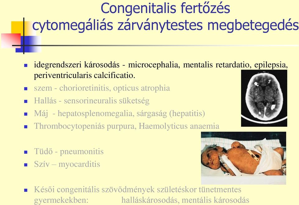 szem - chorioretinitis, opticus atrophia Hallás - sensorineuralis süketség Máj - hepatosplenomegalia, sárgaság